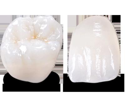 China Emergency Temporary Emax Dental Bridge Teeth Emax Restorations for sale