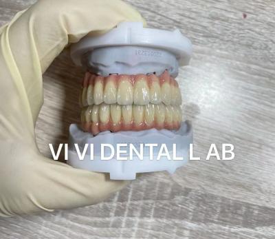 China Coronas dentales digitales precisas con puente de implante bucal completo de zirconia en venta