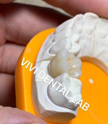 China El laboratorio dental sólido corona la favorable alta translucidez 3D que la circona llena corona el laboratorio dental de China en venta
