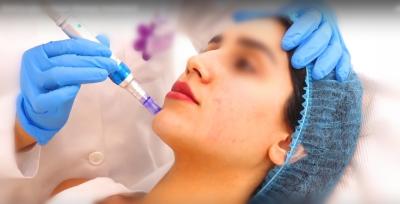 China Female Non Cross Linked HA Dermal Filler Deeply Skin Repairing Solution for sale