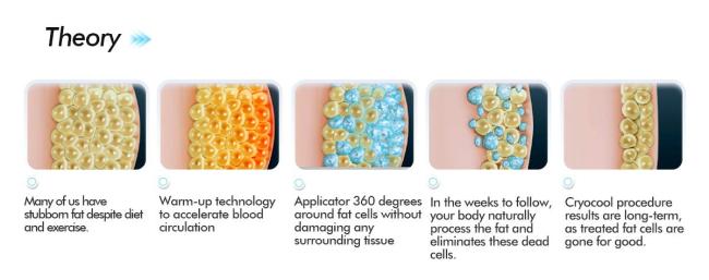 cryolipolysis slimming cryolipolysis slimming