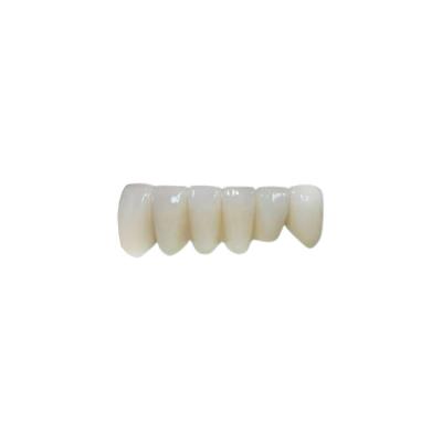 China Ponte fixa da zircônia da coroa dental completa do zirconita do OEM do contorno à venda