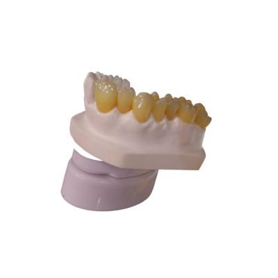 Cina Stampatore dentario Dental Crowns del laboratorio 3D della corona di progettazione PFM di camma di cad in vendita