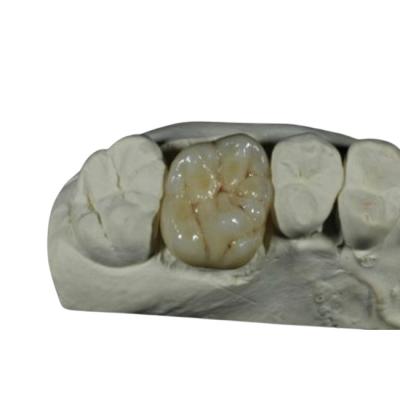 中国 背部歯の復帰のためのセリウムISOの適用範囲が広い磁器の歯科王冠 販売のため