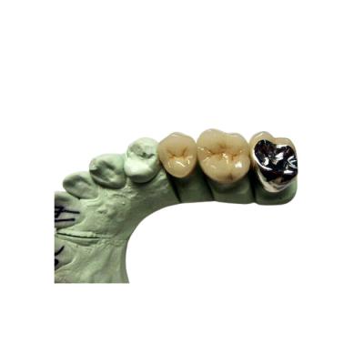 中国 背部歯の復帰のために溶ける高いBiocompatibility PFMの王冠の磁器 販売のため