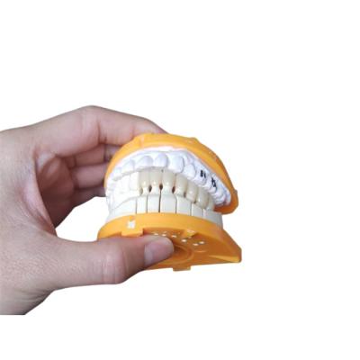 中国 後部および前方の歯のための注文のサイズPFMの陶磁器の王冠 販売のため