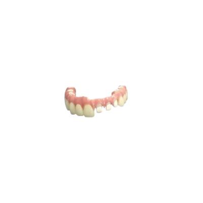 China Coroa dental removível do titânio individual flexível para a clínica dental à venda