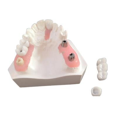China Boa barra inter biológica do implante dental da miscibilidade com aprovação de FDA à venda