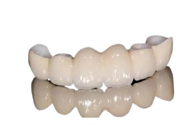 中国 前歯/背部歯のための防蝕磁器の歯科王冠の自然な出現 販売のため