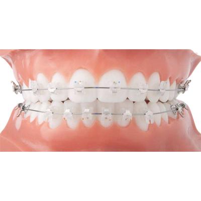 China Easy Clean Orthodontic Ceramic Bracket Beautiful Fixed Orthodontic Appliances for sale
