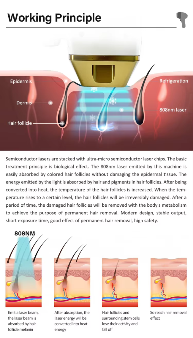 diode laser (2).png