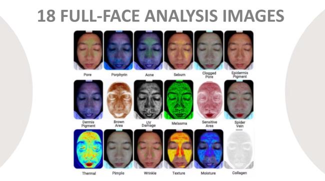 Professional skin analysis machine in clinical setting