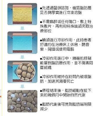 China Multi-polar RF Cavitation Cryolipolysis Slimming Machine Strong Sonic Instrument Negative for sale