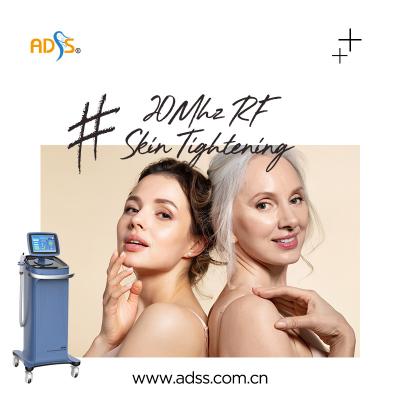 China Skin Tightening Thermage RF Machine 20MHz For Commercial for sale
