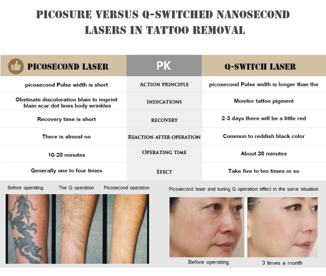 S.Korea Pico Care Laser Machine Q Switched Picosecond ND Yag for Skin Tattoo Removal 1064 532 755 nm Pigment Laser
