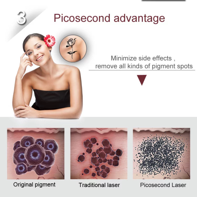 S.Korea Pico Care Laser Machine Q Switched Picosecond ND Yag for Skin Tattoo Removal 1064 532 755 nm Pigment Laser