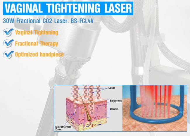 Beauty scar removal co2 laser vagina tightening product wrinkle removal co2 laser vagina tightening