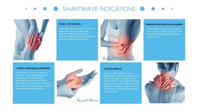 Orthopedics rehabilitation tennis elbows ESWT therapy machine Tendonosis physical therapy Trigger Finger shock wave machine
