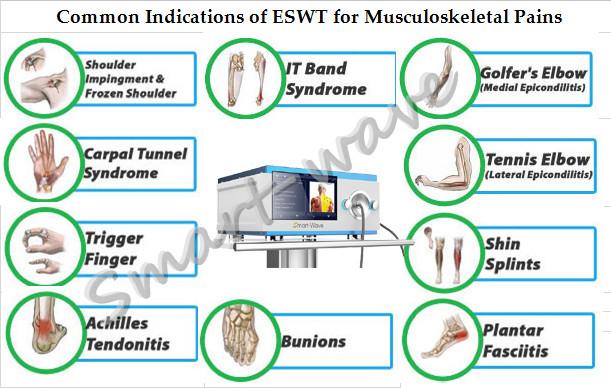 Electromagnetic shock wave therapy pain relief extracorporeal shock wave therapy equipment foot care shock wave