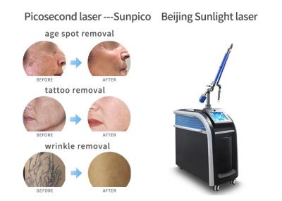 China Vertical Picosecond Laser Tattoo Removal Machine Pigmentation Removal Acne Treatment for sale