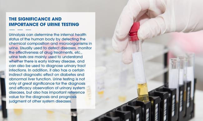 Urine Test Strips in use with sample collection