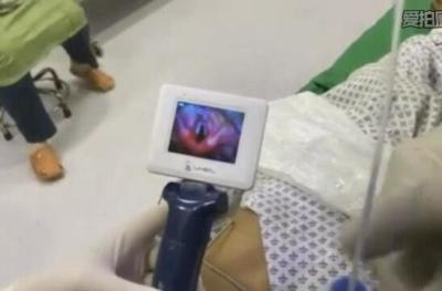 China Portable Video Laryngoscope Flexible Fiberoptic Diagnostic Mac 4 Blade Intubation  for sale