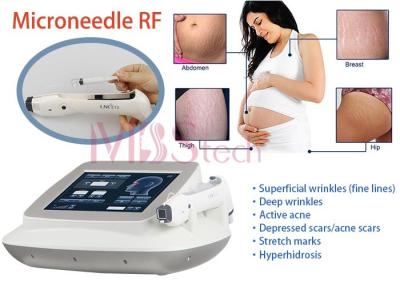 China Stretch Marks Removal Face Lifting Rf Microneedle Machine for sale