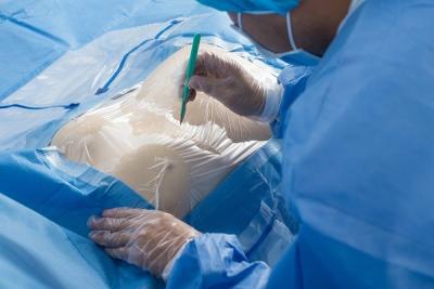 China Paquetes quirúrgicos de encargo de puente, envolviendo eficacia alta de los paquetes quirúrgicos en venta