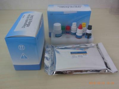 China Kit de prueba Hbsag Elisa para dispositivos de diagnóstico médico aprobados por el CE en venta