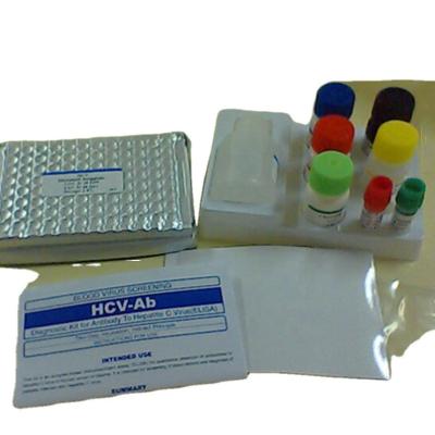 Chine Toxo Igg Elisa Test Kit Medical Device MFDS a approuvé à vendre