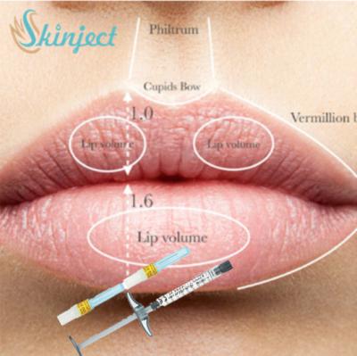 China Full Lip Cheek Injectable Dermal Filler Hyaluronic Acid HA Filler 1ml 2ml 5ml for sale