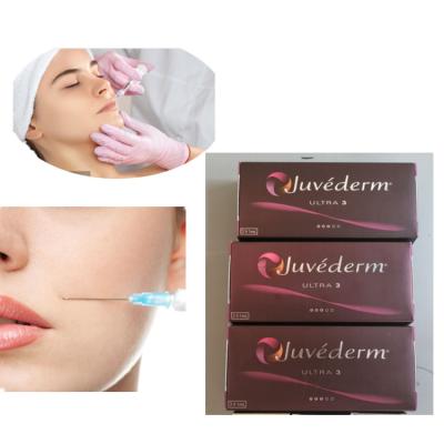 China Injection Juvederm 2x1ml Ultra 3 Lip Dermal Filler 24mg/Ml for sale