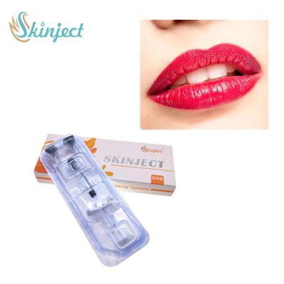 China Hyaluronic Acid Dermal Filler Lip Injections 1ml 2ml 5ml Derm Lip Implants for sale
