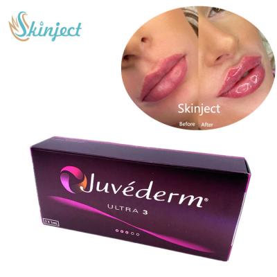 China Juvederm Ultra3 2x1ml Hyaluronic Acid Facial Fillers Dermal for sale