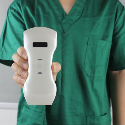 China Portable Pregnancy Scanning Machine Wireless Probe  Micro Medical for sale