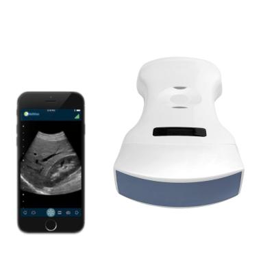 China Heart Three-In-One Ultrasound Scanner Machine  Handheld Scanner for sale