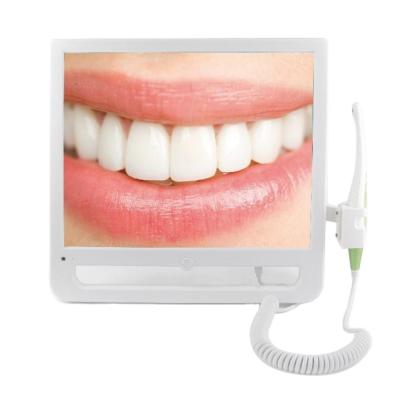 China Digital X-Ray Sensors Dental Intra Oral Camera  Intraoral Dental Usb for sale