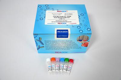 China Lyophilized IVD ANVISA Fluorescence PCR Detection Kit 40T/box for sale