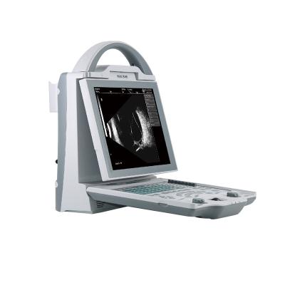China Ultrasound Scanning LCD Ophthalmological Instruments With 10MHz A Probe for sale