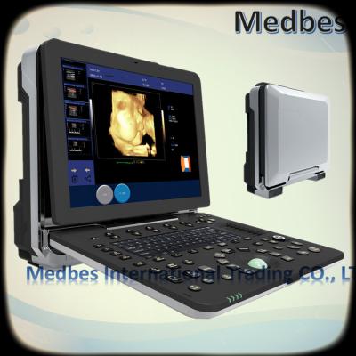 China 4D Color Doppler Ultrasound Diagnosis System 4D Color Digital Portable Cardiac Ultrasound Scanner for sale