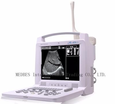 China 96 elements Medical Diagnosis Equipment Medical Instrument Diagnosis System Portable Ultrasound Scanner for sale