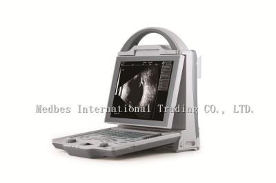 China Full digital A/B scan portable cheapest Ophthalmic Ultrasound for sale