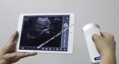 China Ipad connecting Wireless Convex Probe Ultrasound Scanner with built-in battery for sale