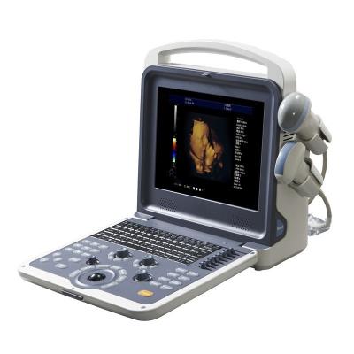 China Abdomen, gynecology, obstetrics, cardiology, small parts, urolog Ultrasound Machine for sale
