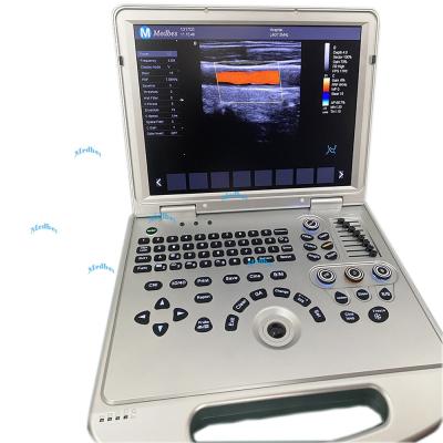 China Chinese Full Digital Laptop 4D 5D Human Color Ultrasound  Scanner  portable  Laptop ultrasound machine  for pregnancy for sale