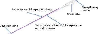 China Funcionamiento Kyphoplasty Kit Vertebral Expansion Balloon Kit de la seguridad fácil actuar en venta