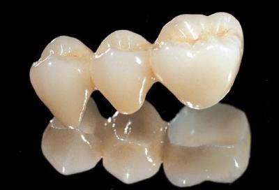 China All Ceramic Zirconia Dental Crown for sale