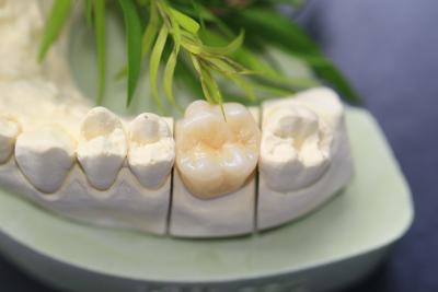 China Monolithic Zirconia Dental Crown For Molars Posterior Teeth for sale