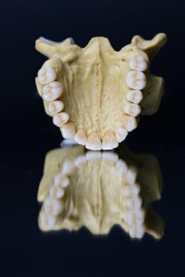 China Dental Lab Porcelain Zirconia Dental Crown 5 Stars Esthetics for sale