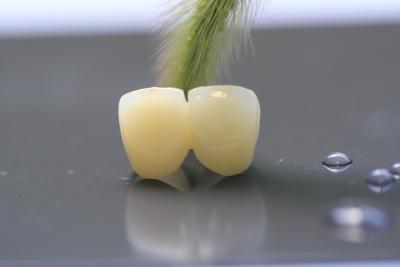 China 3D Print Framework PFM Dental Lab Crown For Dentistry for sale